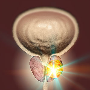 Metabolic enzyme implicated in prostate cancer