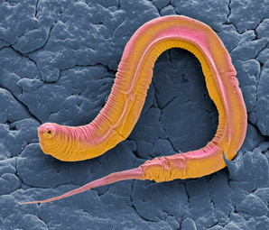 Anti-cancer protein linked to healthy ageing