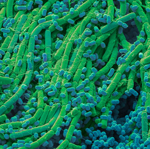 Soil bacterium can breakdown the red dye from cochineal beetle