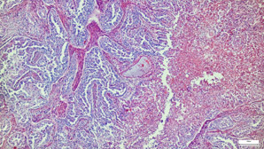 Protein keeps liver metabolism in check