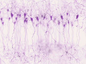 Axon-carrying dendrite neurons rare in primates