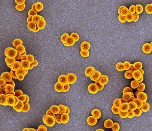 One way antibiotic resistance spreads among bacteria