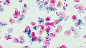 Protein regulates transition from sedentary to migratory cells