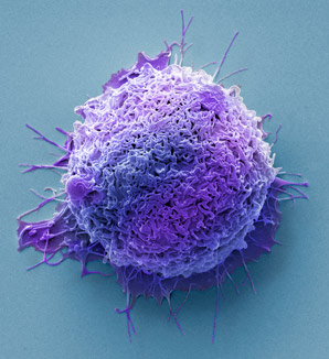 Enzyme makes cancer cells invasive