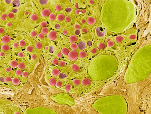 Measuring zinc in insulin-producing cells