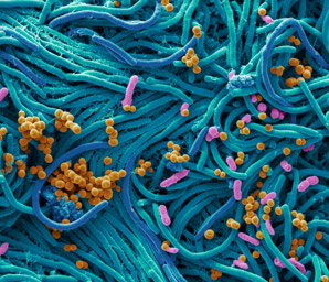 A bacterial molecule both defends and attacks